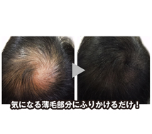 Stealth Powder for Increased Hair Volume Before and after image